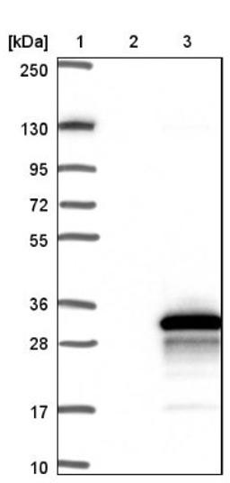 Western Blot: TSC21 Antibody [NBP1-91727] - Lane 1: Marker [kDa] 250, 130, 95, 72, 55, 36, 28, 17, 10<br/>Lane 2: Negative control (vector only transfected HEK293T lysate)<br/>Lane 3: Over-expression lysate (Co-expressed with a C-terminal myc-DDK tag (~3.1 kDa) in mammalian HEK293T cells, LY407389)