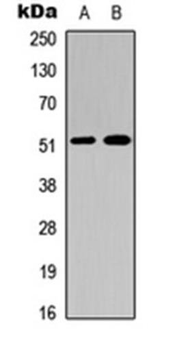 Western blot analysis of A549 (Lane 1), NS-1 (Lane 2) whole cell lysates using Factor IX HC antibody