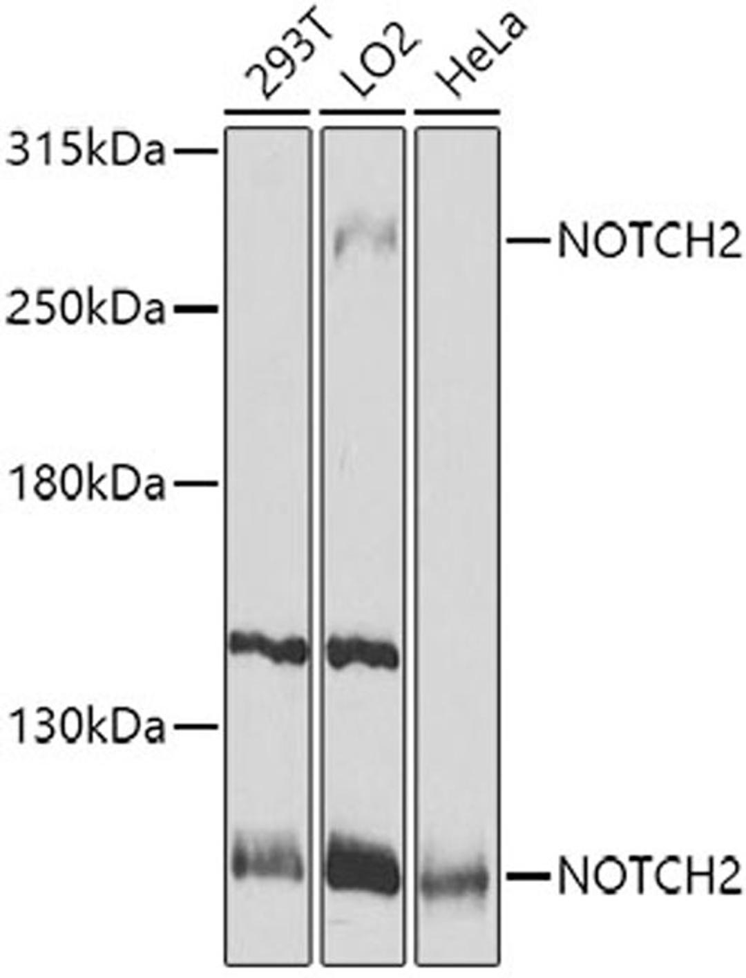 Western blot - NOTCH2 antibody (A0560)