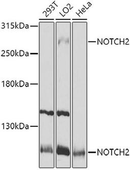 Western blot - NOTCH2 antibody (A0560)