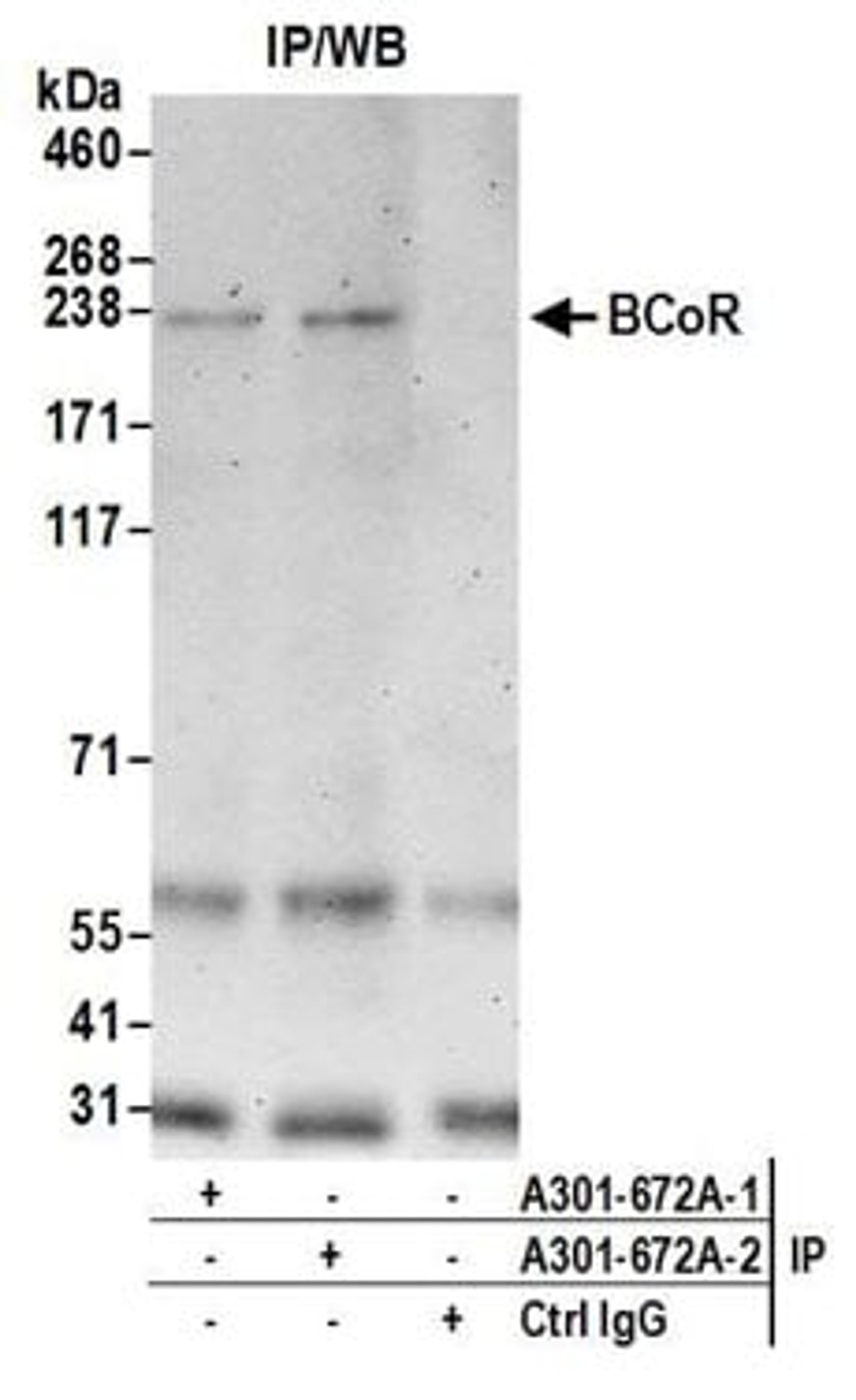 Detection of human BCoR by western blot of immunoprecipitates.