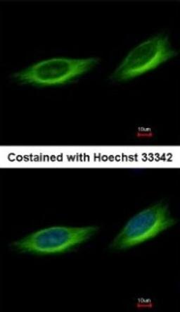 Immunocytochemistry/Immunofluorescence: TULP1 Antibody [NBP1-31401] - Analysis of methanol-fixed HeLa, using antibody at 1:500 dilution.