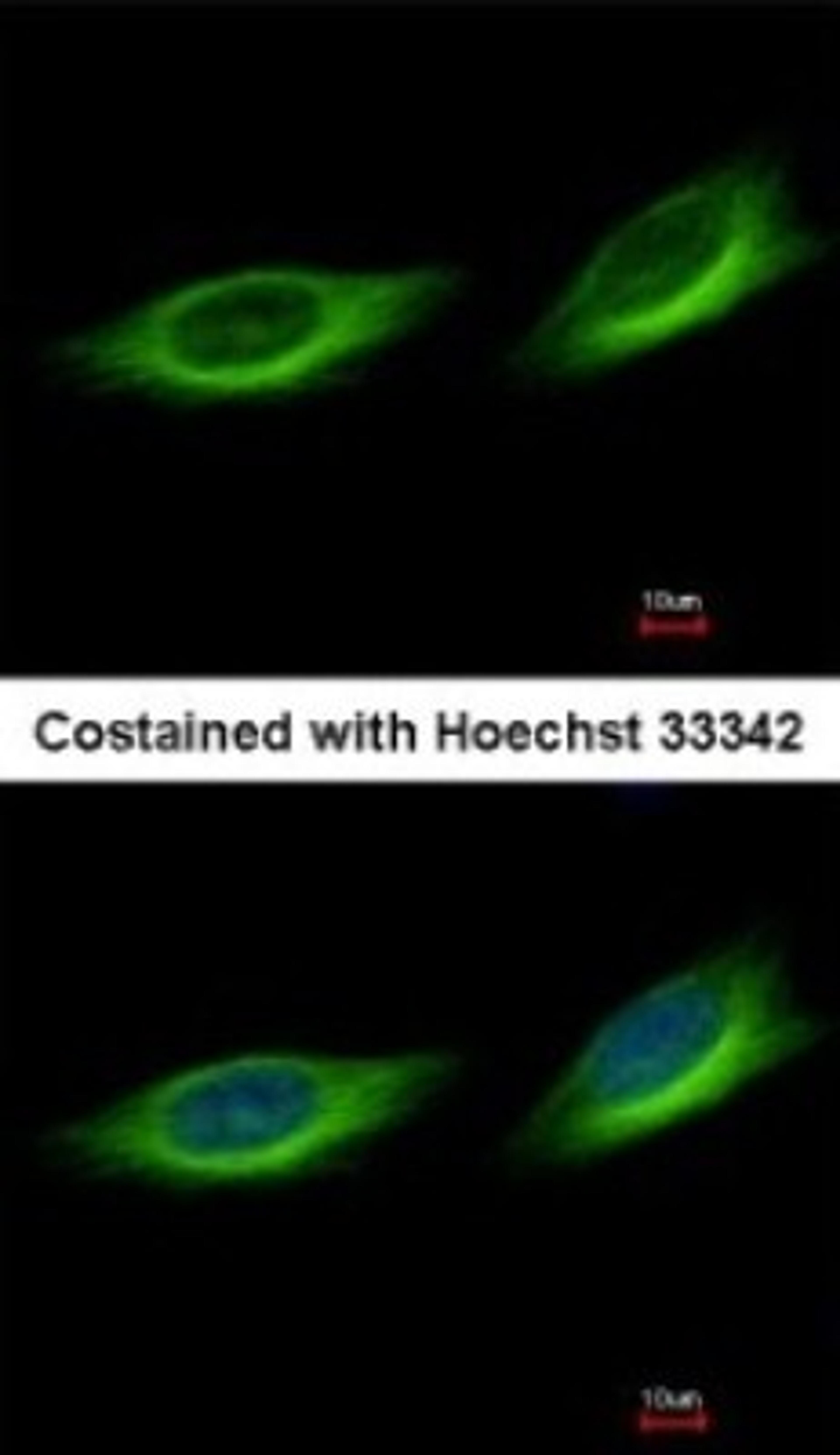 Immunocytochemistry/Immunofluorescence: TULP1 Antibody [NBP1-31401] - Analysis of methanol-fixed HeLa, using antibody at 1:500 dilution.