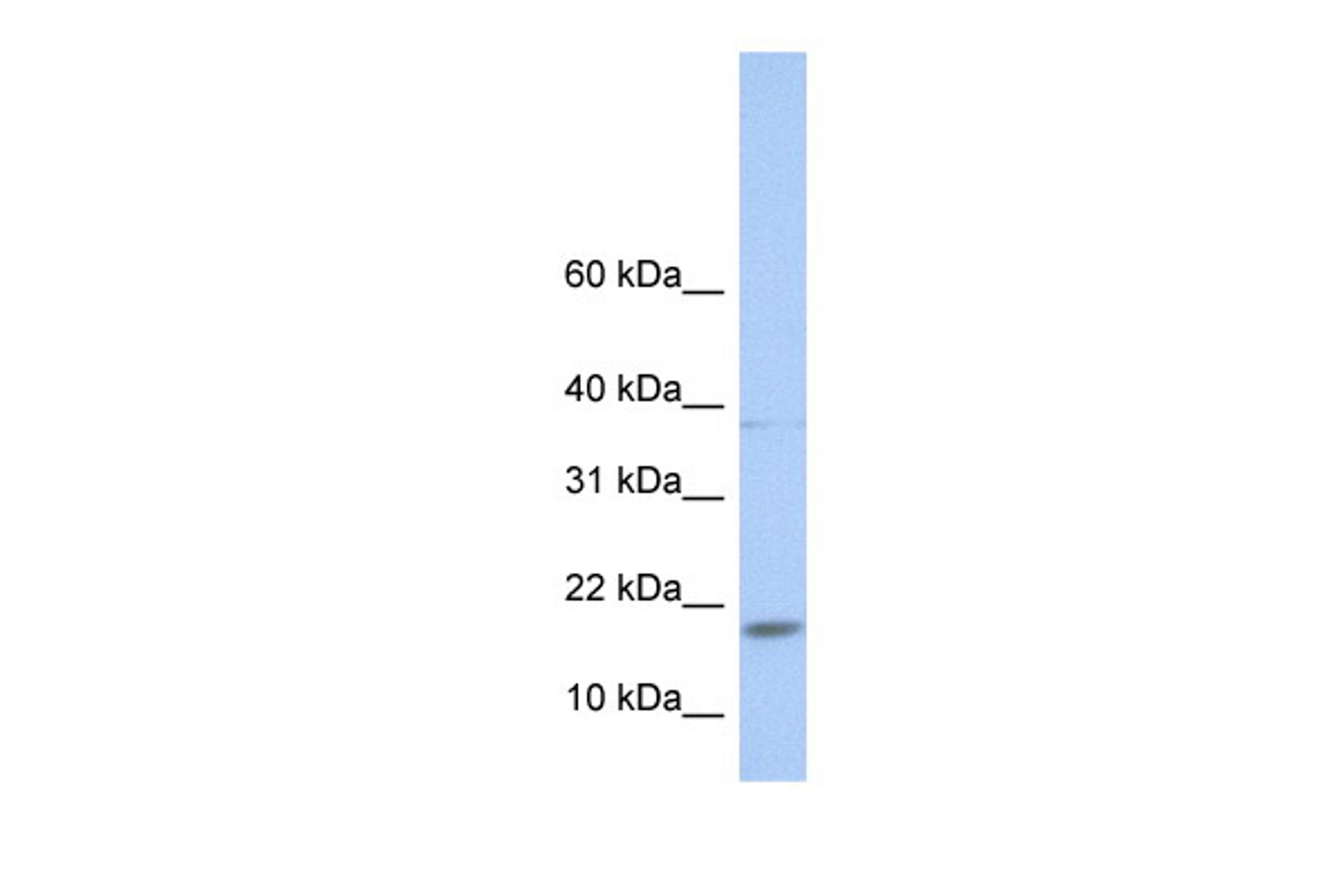 Antibody used in WB on Human Lung at 0.2-1 ug/ml.