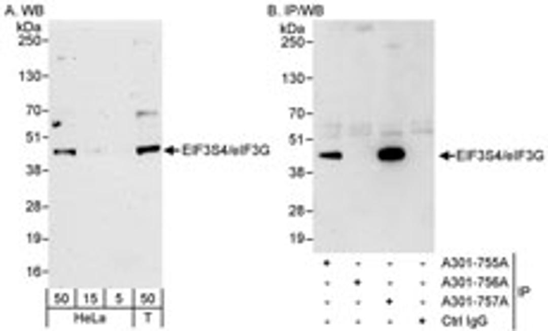 Detection of human eIF3G/EIF3S4 by western blot and immunoprecipitation.