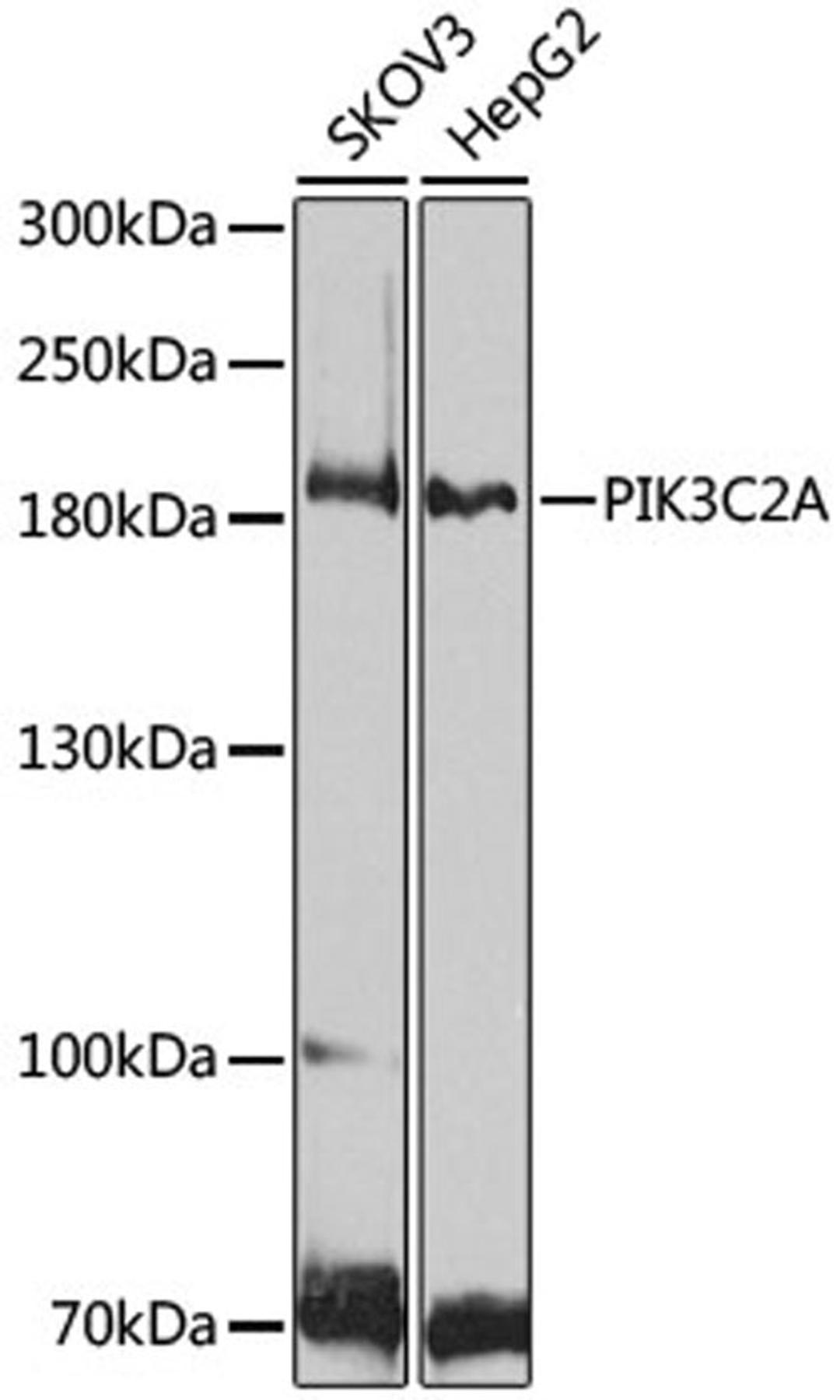 Western blot - PIK3C2A antibody (A8526)