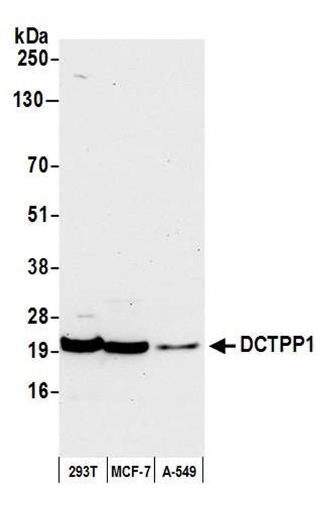 Detection of human DCTPP1 by WB.