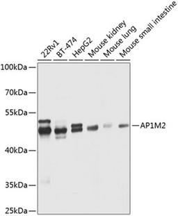 Western blot - AP1M2 antibody (A8331)