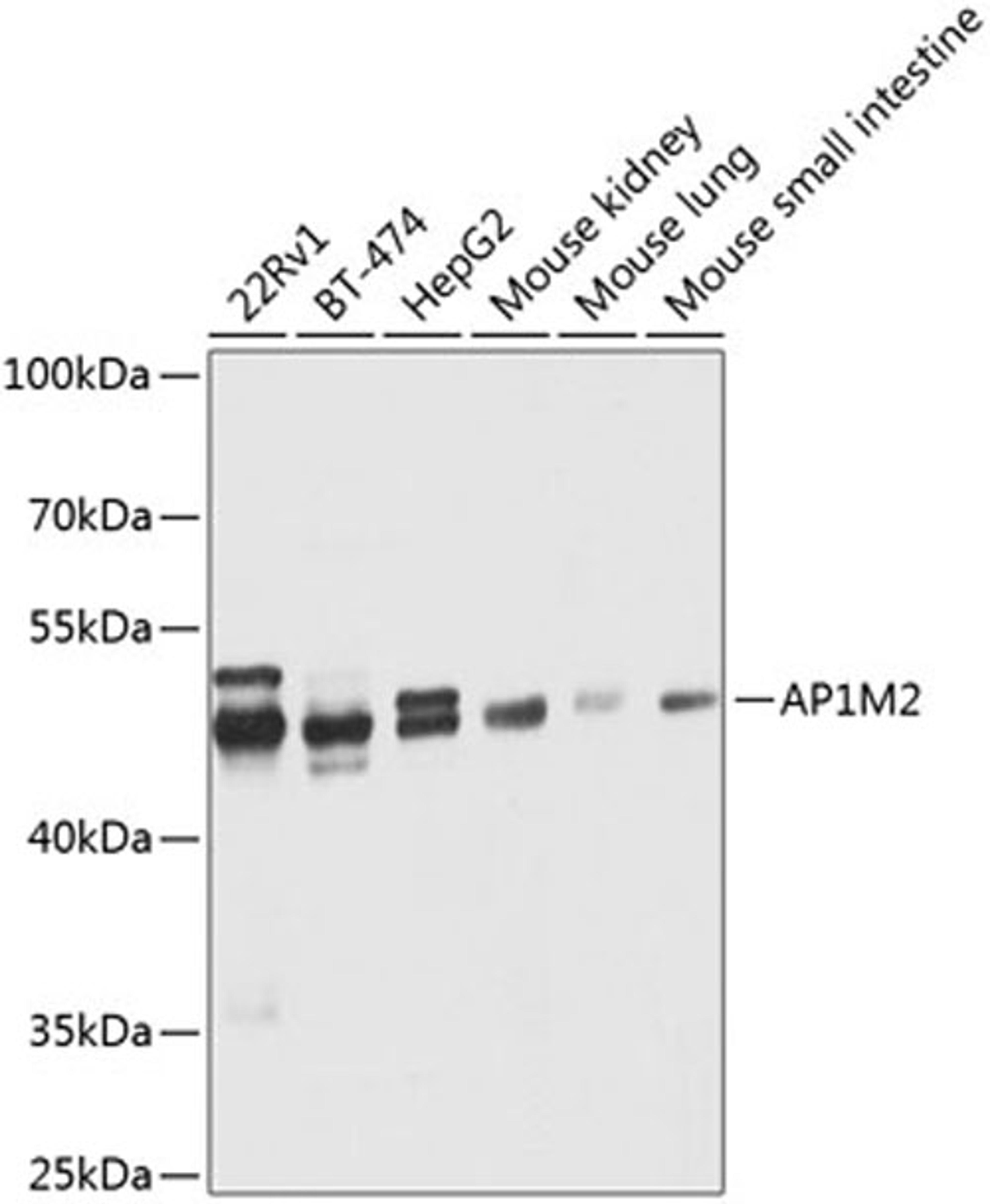 Western blot - AP1M2 antibody (A8331)