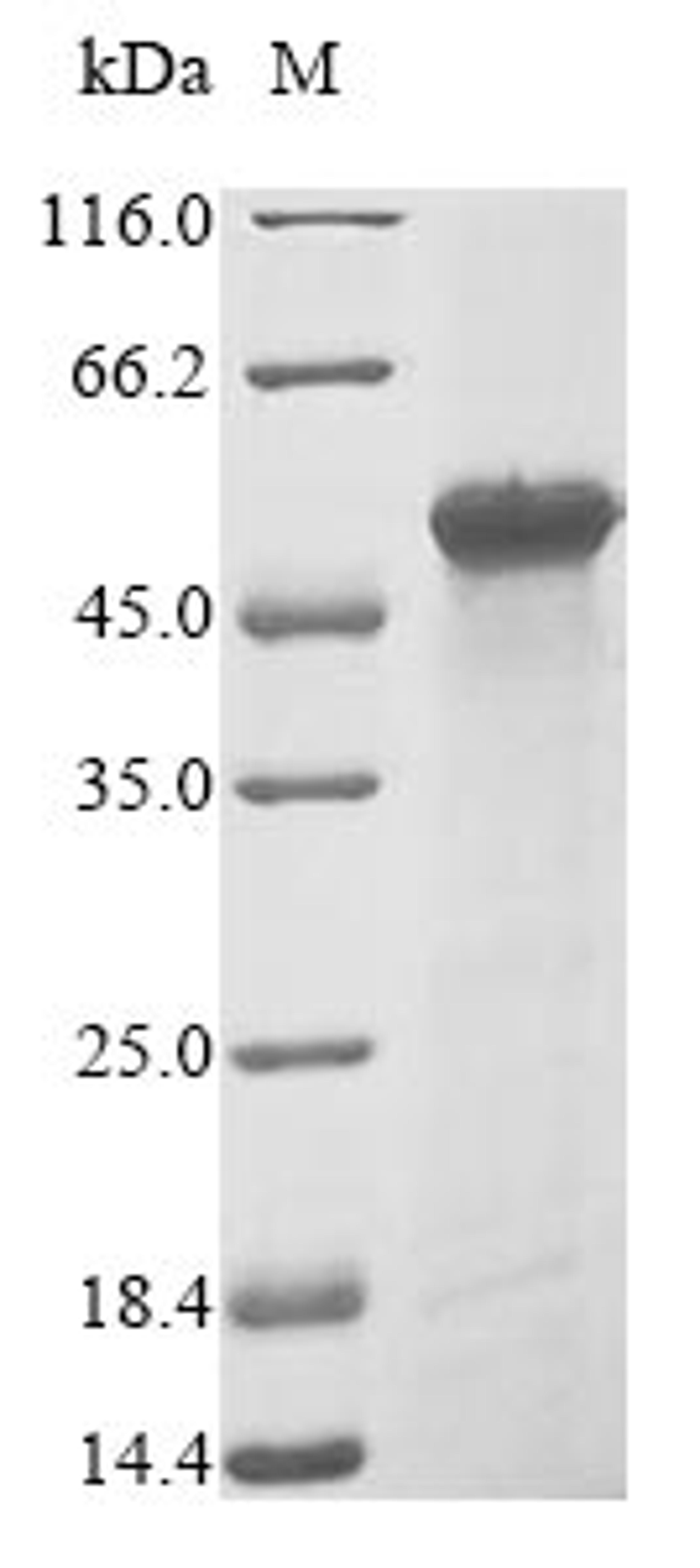 (Tris-Glycine gel) Discontinuous SDS-PAGE (reduced) with 5% enrichment gel and 15% separation gel.