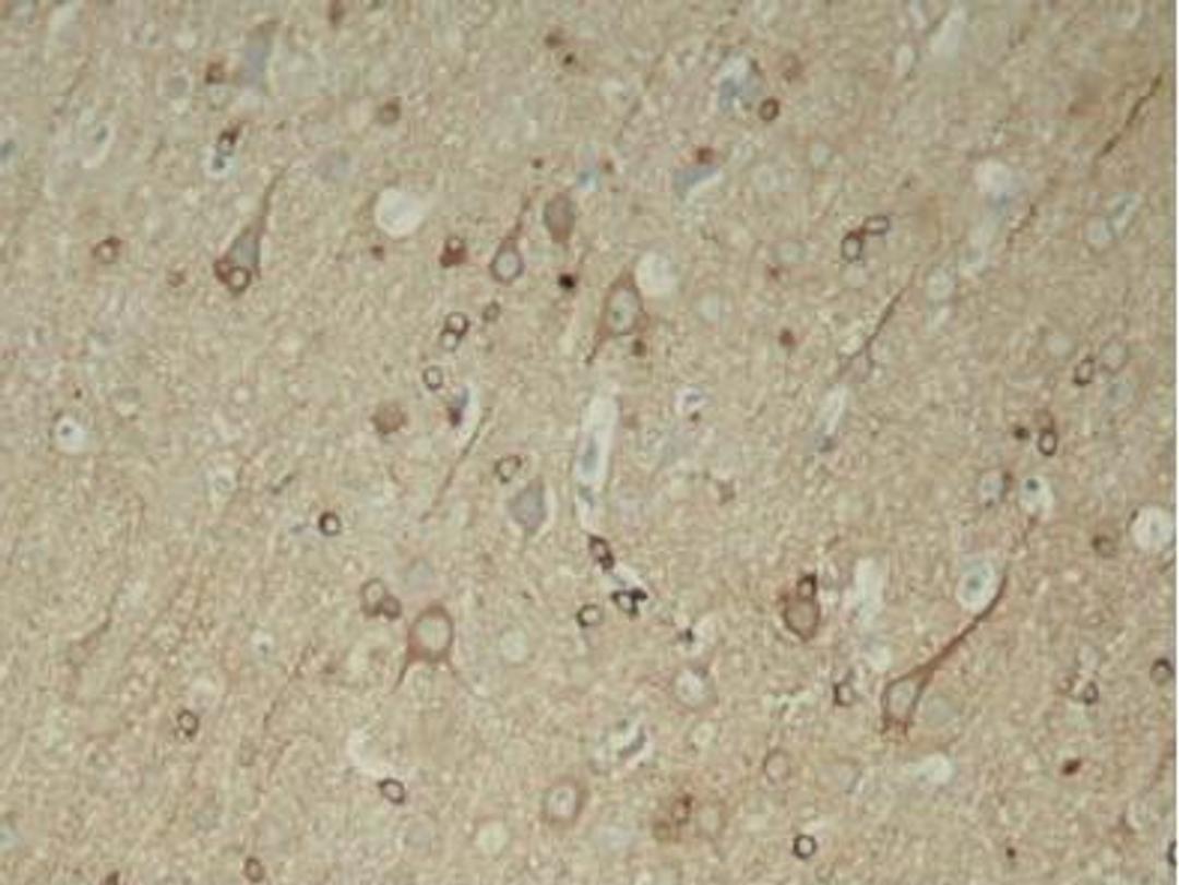 Immunohistochemical analysis of paraffin-embedded rat hippocampal region tissue from a model with Alzheimer�s Disease using Tau (phospho-Ser396) antibody