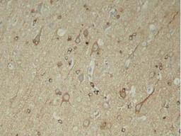 Immunohistochemical analysis of paraffin-embedded rat hippocampal region tissue from a model with Alzheimer�s Disease using Tau (phospho-Ser396) antibody