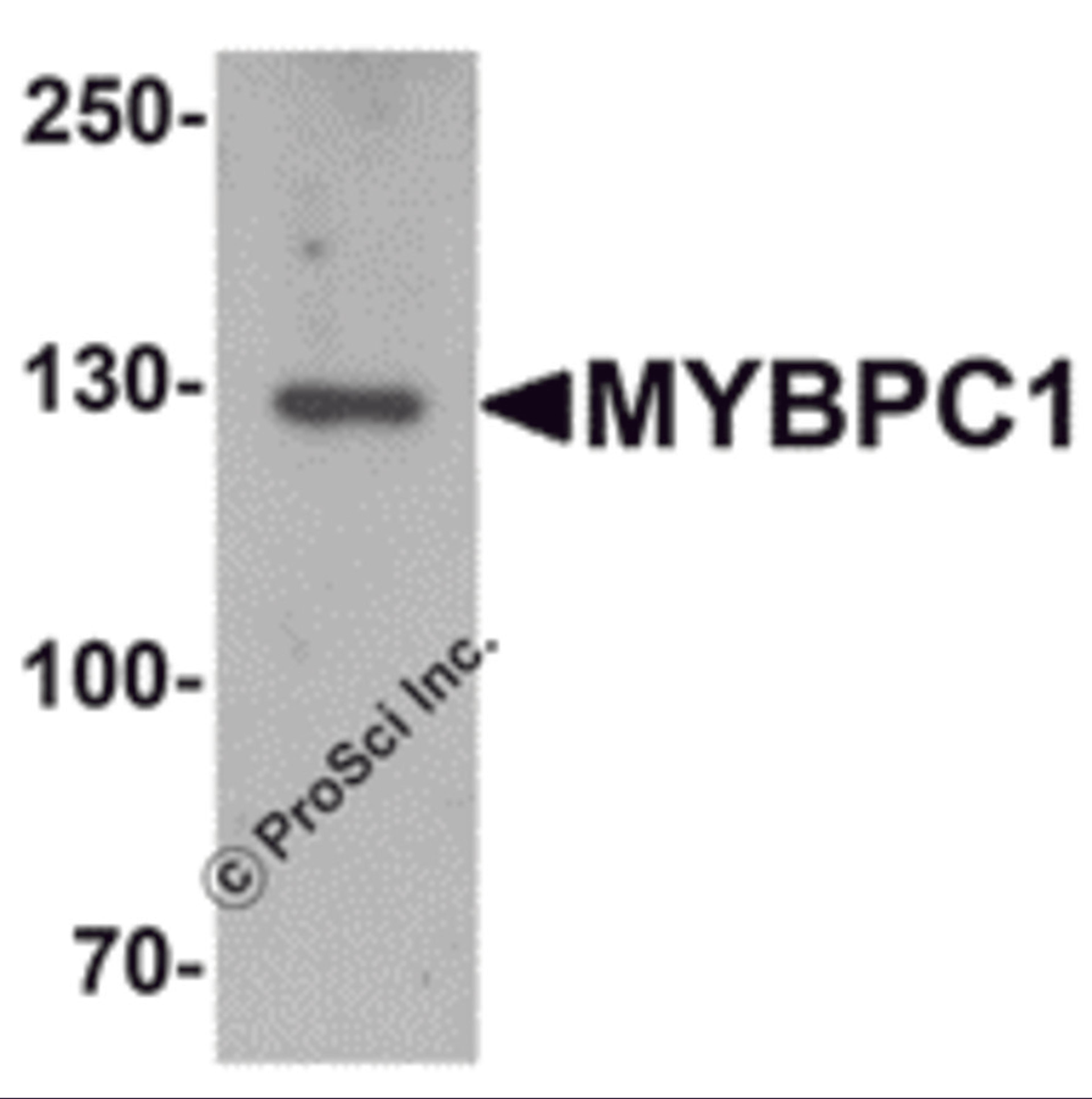 Western blot analysis of MYBPC1 in rat skeletal muscle tissue lysate with MYBPC1 antibody at 1 &#956;g/mL.