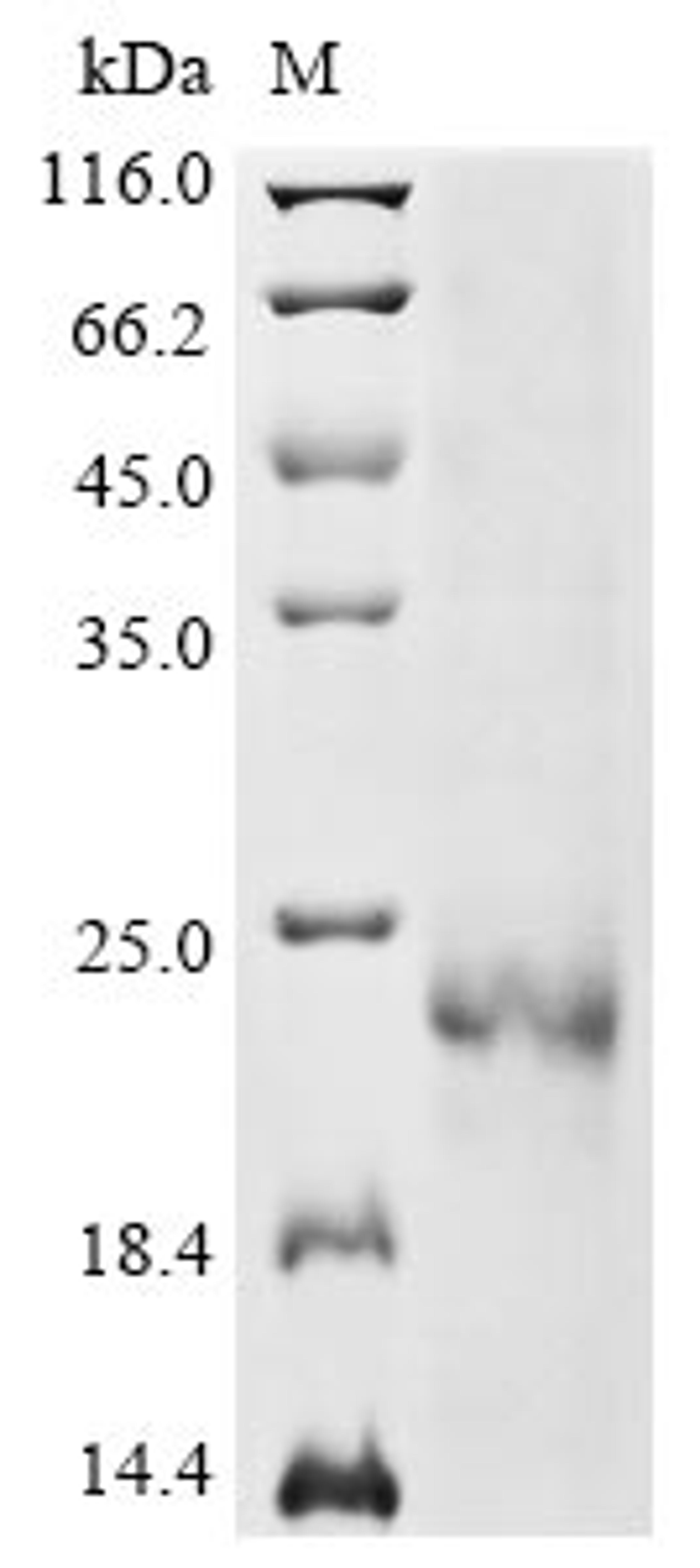 (Tris-Glycine gel) Discontinuous SDS-PAGE (reduced) with 5% enrichment gel and 15% separation gel.