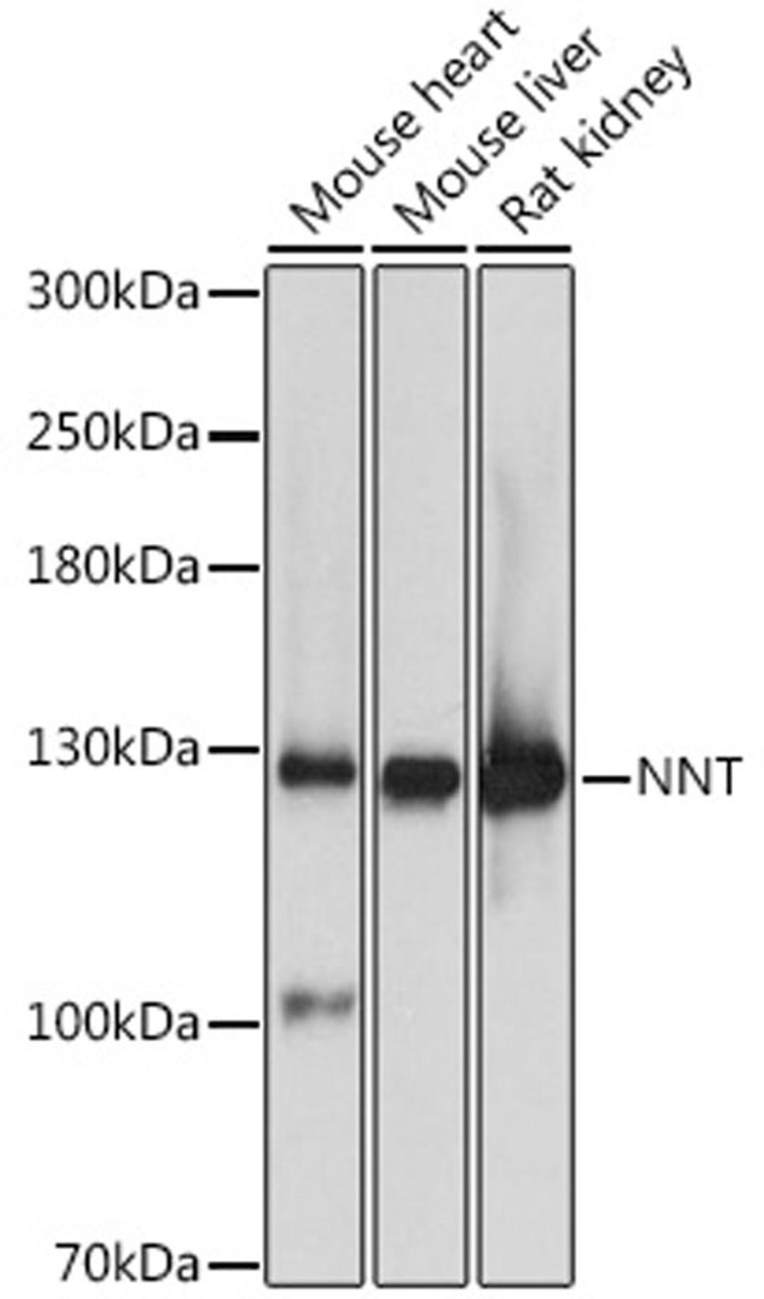 Western blot - NNT antibody (A4561)