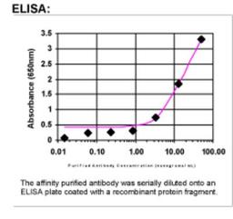 ELISA: Thrombospondin-2 Antibody [24420002]