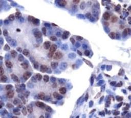 Immunohistochemistry: LPIN1 Antibody [NB110-57150] - Staining of LPIN1 in mouse pancreas.