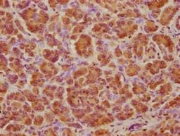 IHC image of CSB-PA002396LA01HU diluted at 1:100 and staining in paraffin-embedded human pancreatic tissue performed on a Leica BondTM system. After dewaxing and hydration, antigen retrieval was mediated by high pressure in a citrate buffer (pH 6.0). Section was blocked with 10% normal goat serum 30min at RT. Then primary antibody (1% BSA) was incubated at 4°C overnight. The primary is detected by a biotinylated secondary antibody and visualized using an HRP conjugated SP system.