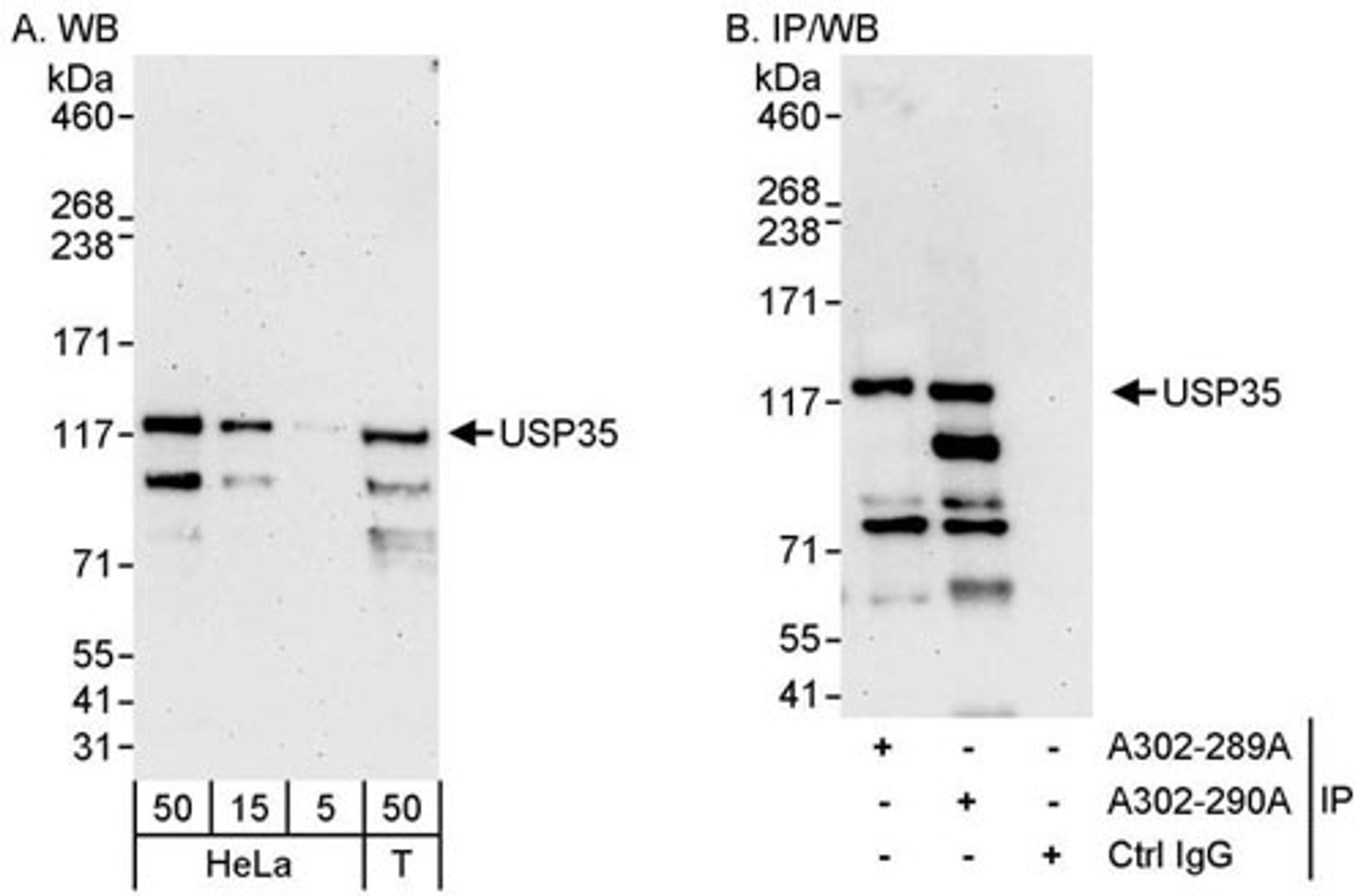 Detection of human USP35 by WB and IP.