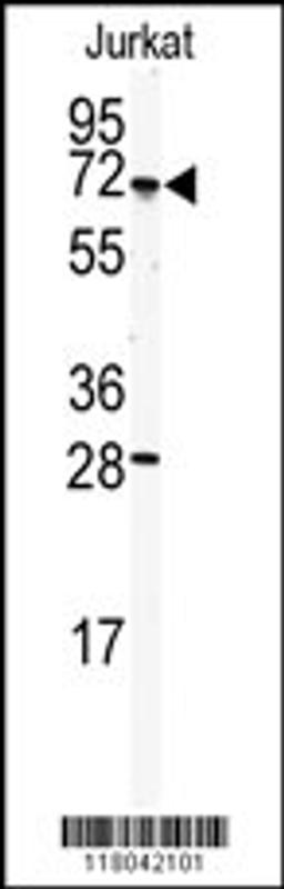 Western blot analysis of anti-CETP Antibody in Jurkat cell line lysates (35ug/lane).