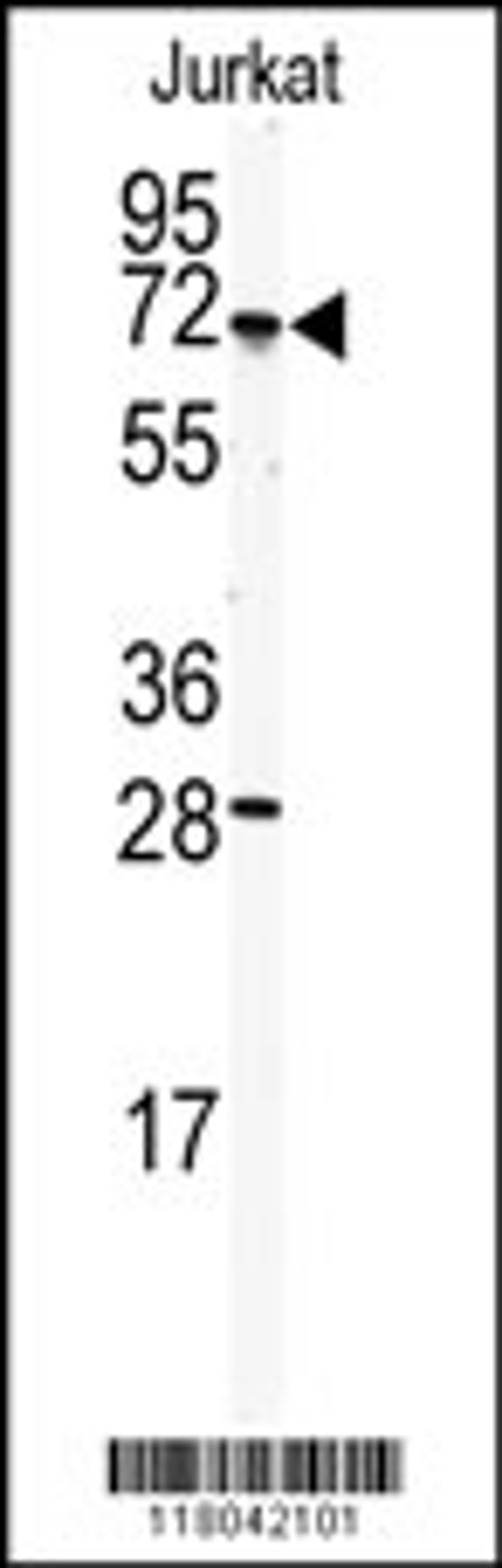 Western blot analysis of anti-CETP Antibody in Jurkat cell line lysates (35ug/lane).