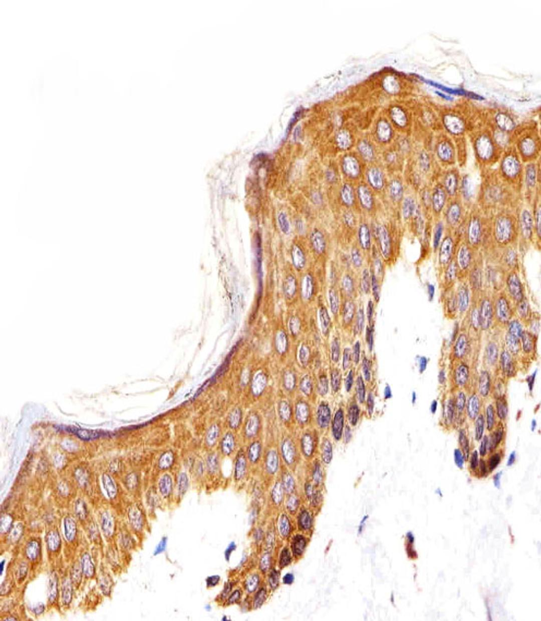 Immunohistochemical analysis of paraffin-embedded H. skin section using EGFR Antibody (N-term). Antibody was diluted at 1:25 dilution. A undiluted biotinylated goat polyvalent antibody was used as the secondary, followed by DAB staining.