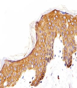 Immunohistochemical analysis of paraffin-embedded H. skin section using EGFR Antibody (N-term). Antibody was diluted at 1:25 dilution. A undiluted biotinylated goat polyvalent antibody was used as the secondary, followed by DAB staining.