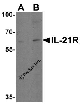 Western blot analysis of IL-21 receptor expression in human HepG2 cell lysate with IL-21 receptor antibody at (A) 1 and (B) 2 &#956;g /ml.