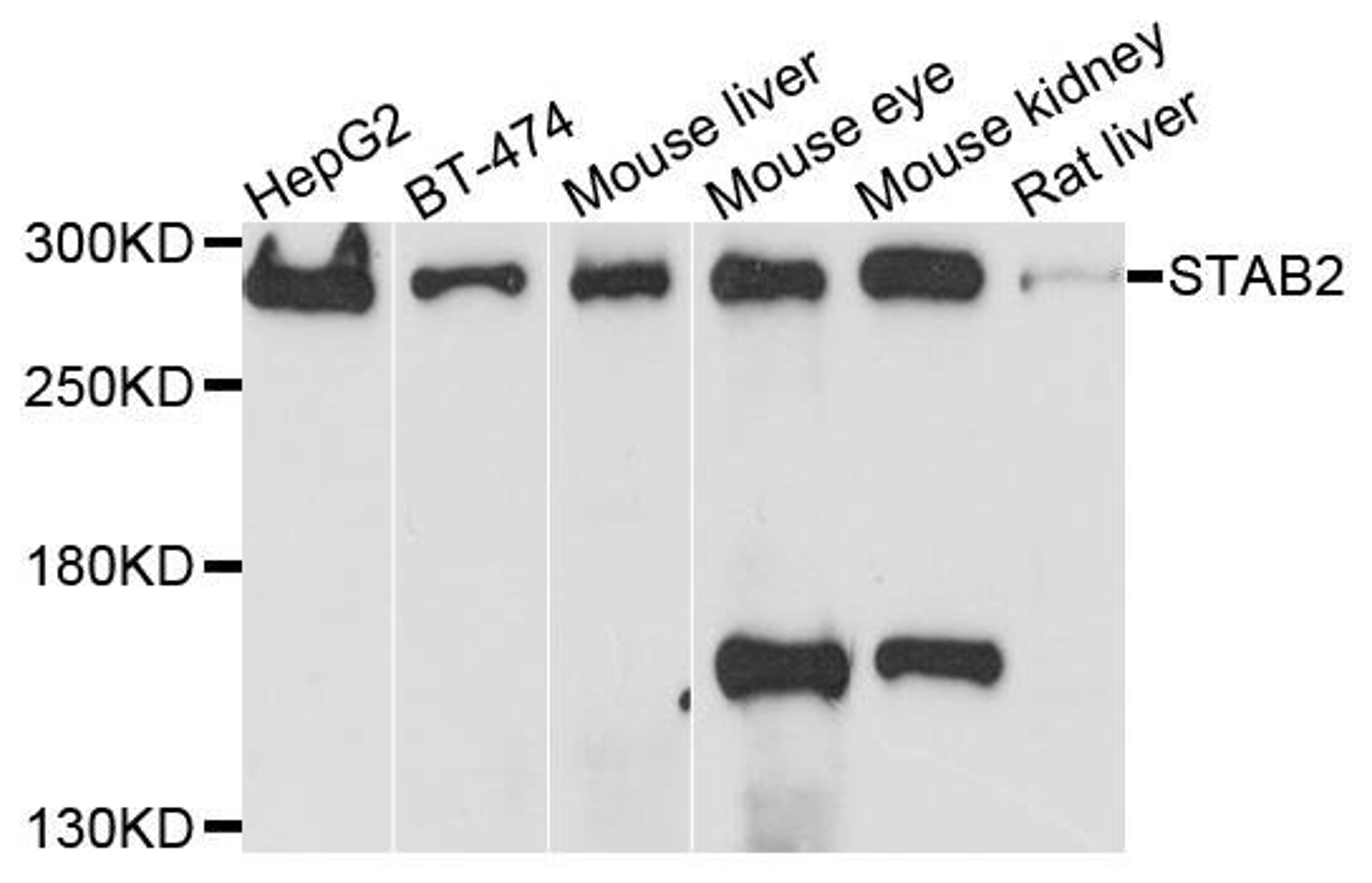 Western blot analysis of extracts of various cells using STAB2 antibody