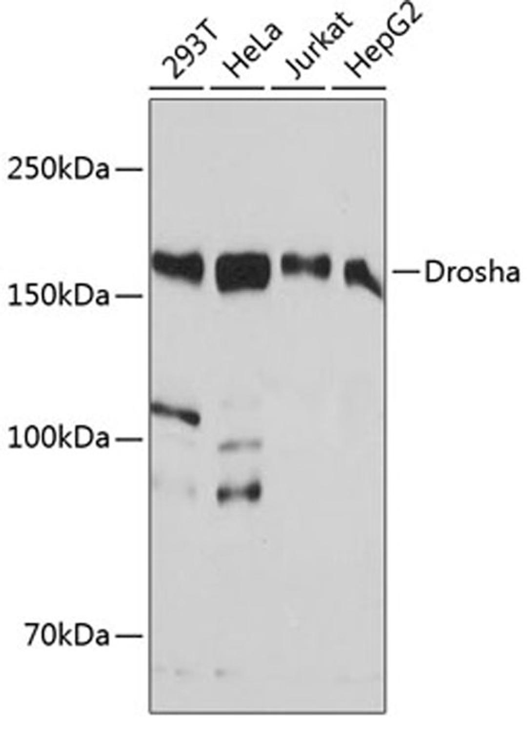 Western blot - Drosha antibody (A19598)