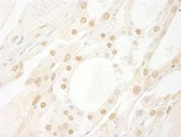 Detection of human B-Myb by immunohistochemistry.