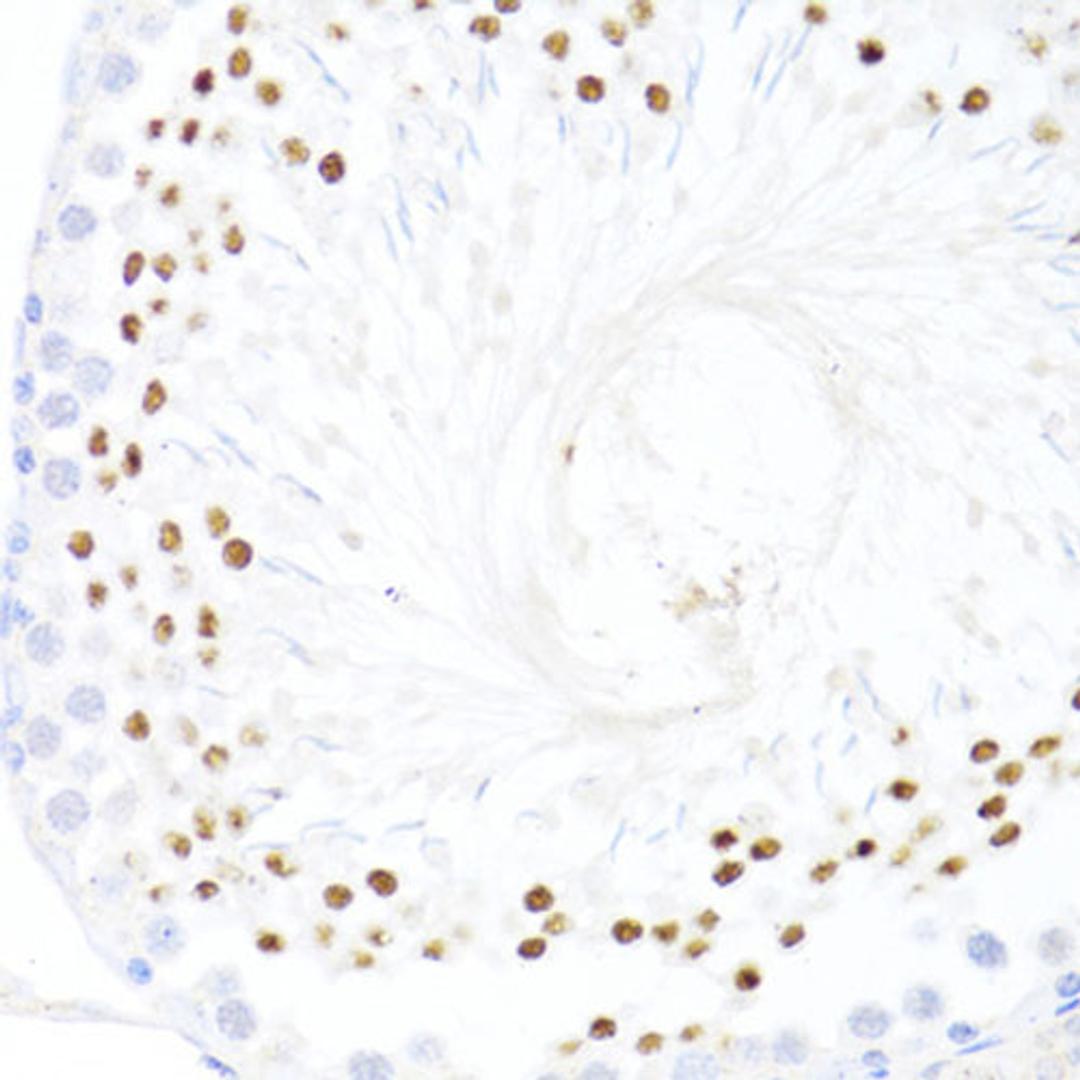 Immunohistochemistry  - DDX59 antibody (A14940)