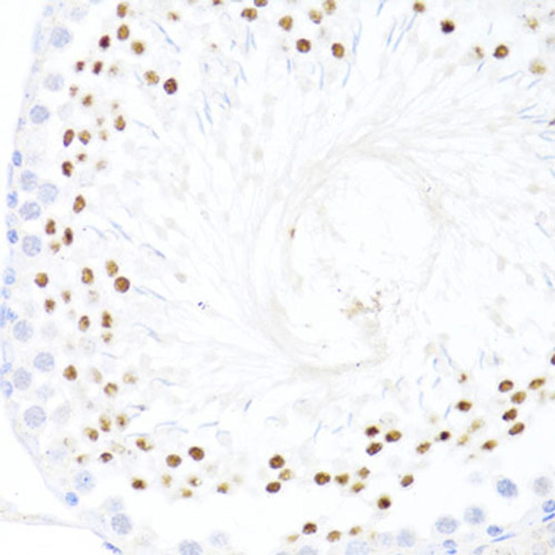 Immunohistochemistry - DDX59 antibody (A14940)