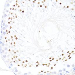 Immunohistochemistry - DDX59 antibody (A14940)