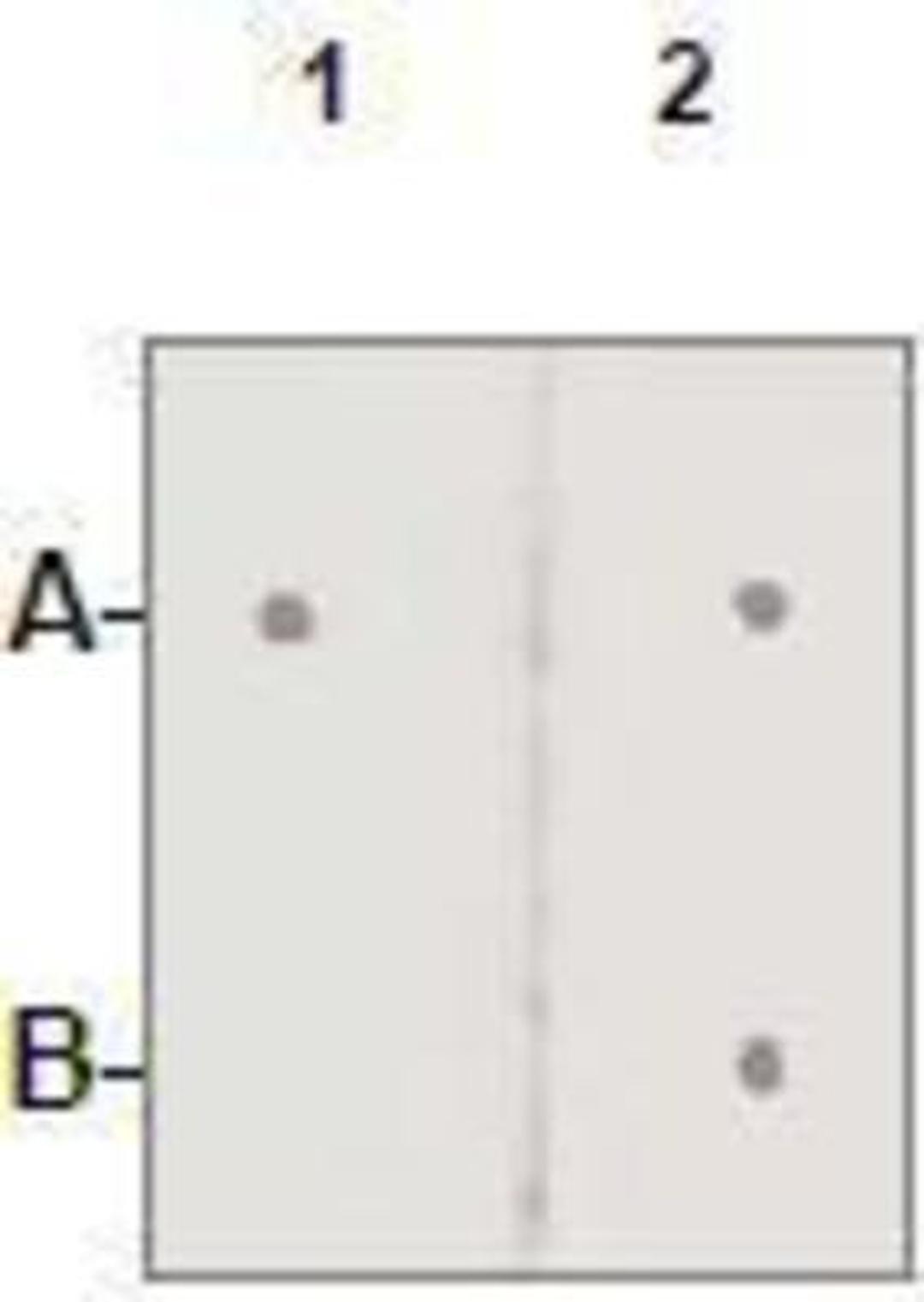 Dot Blot: Androgen Receptor Antibody [NBP1-74687] - 1 mg peptide was blot onto NC membrane A: AR(pS210) B: AR (Nonphospho); were blotted at a 1:2000 dilution by: 1: Rabbit anti-AR (pS210)