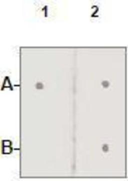 Dot Blot: Androgen Receptor Antibody [NBP1-74687] - 1 mg peptide was blot onto NC membrane A: AR(pS210) B: AR (Nonphospho); were blotted at a 1:2000 dilution by: 1: Rabbit anti-AR (pS210)