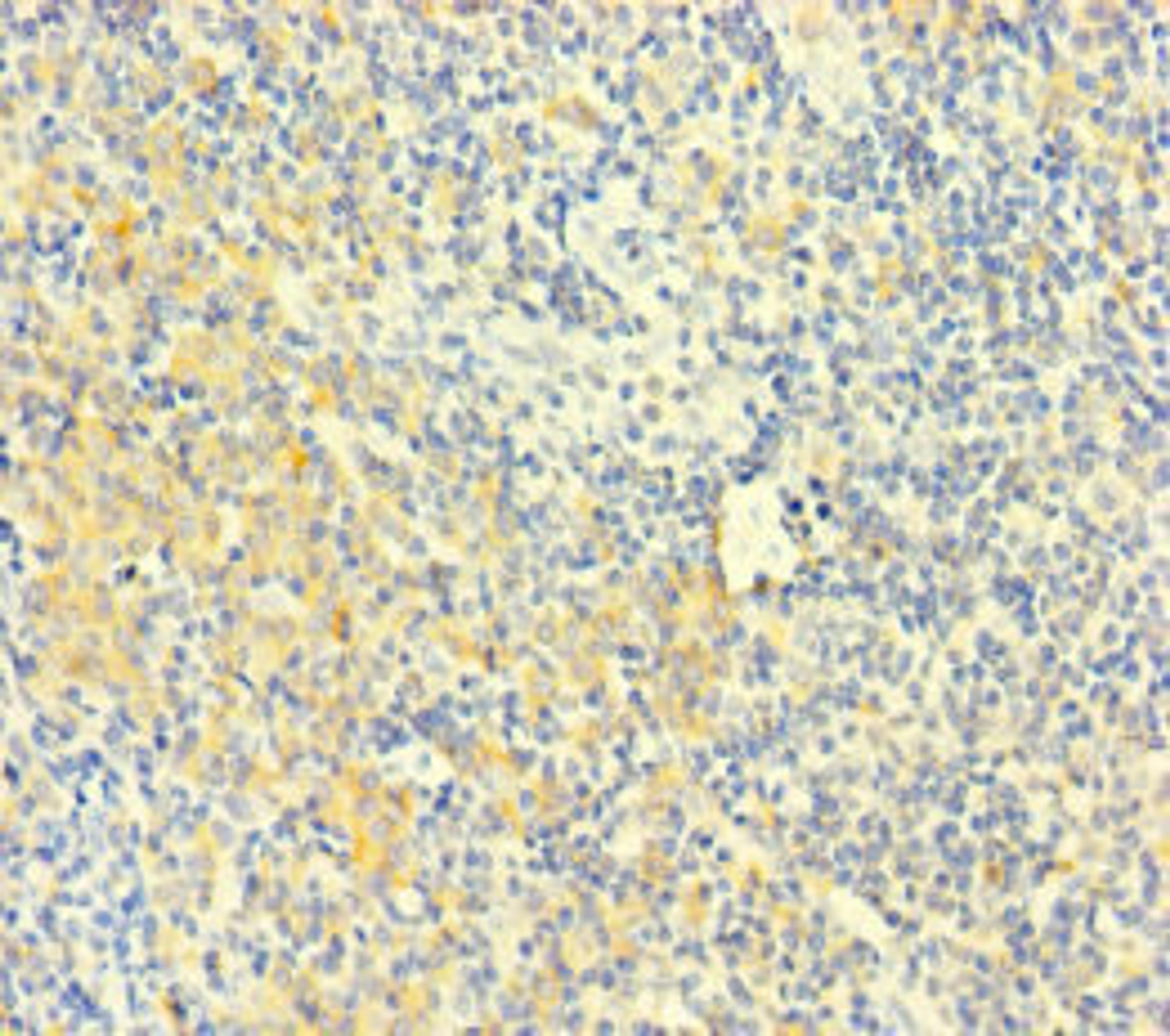 Immunohistochemistry of paraffin-embedded human tonsil tissue using CSB-PA873705LA01HU at dilution of 1:100
