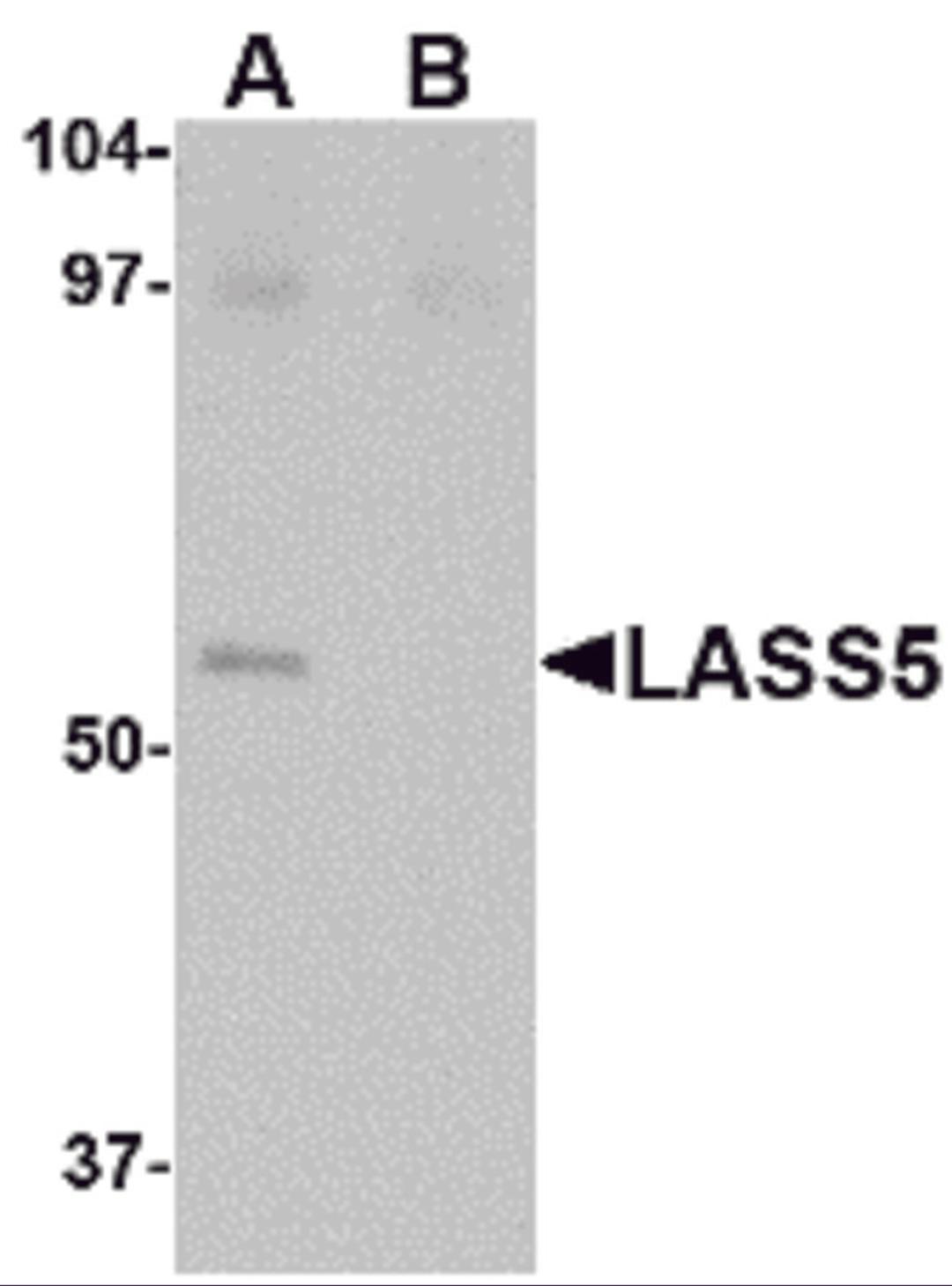 Western blot analysis of LASS5 in SK-N-SH lysate with LASS5 antibody at 1 μg/mL in the (A) absence and (B) presence of blocking peptide.
