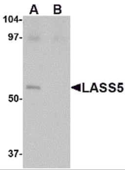 Western blot analysis of LASS5 in SK-N-SH lysate with LASS5 antibody at 1 μg/mL in the (A) absence and (B) presence of blocking peptide.