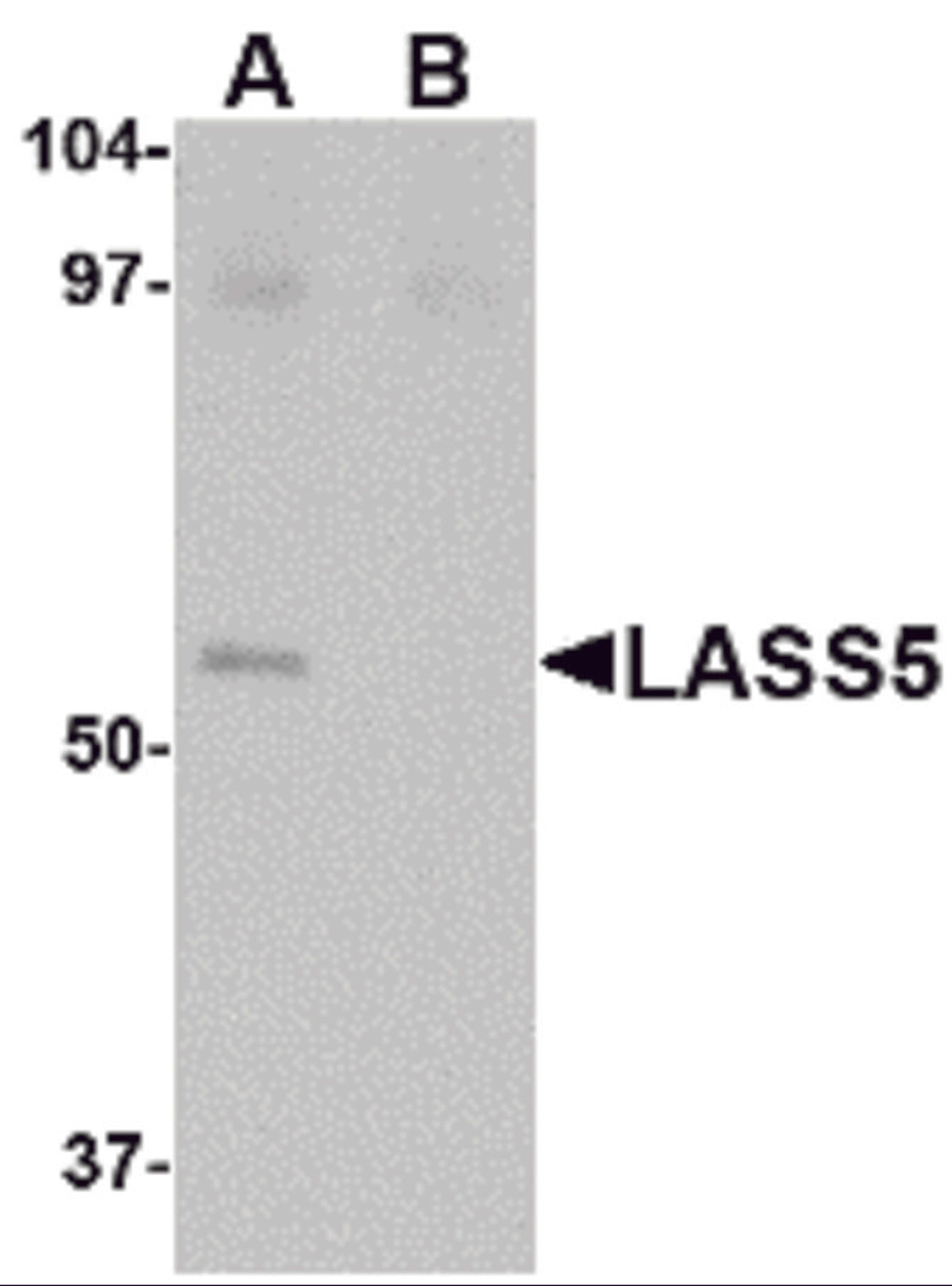 Western blot analysis of LASS5 in SK-N-SH lysate with LASS5 antibody at 1 μg/mL in the (A) absence and (B) presence of blocking peptide.