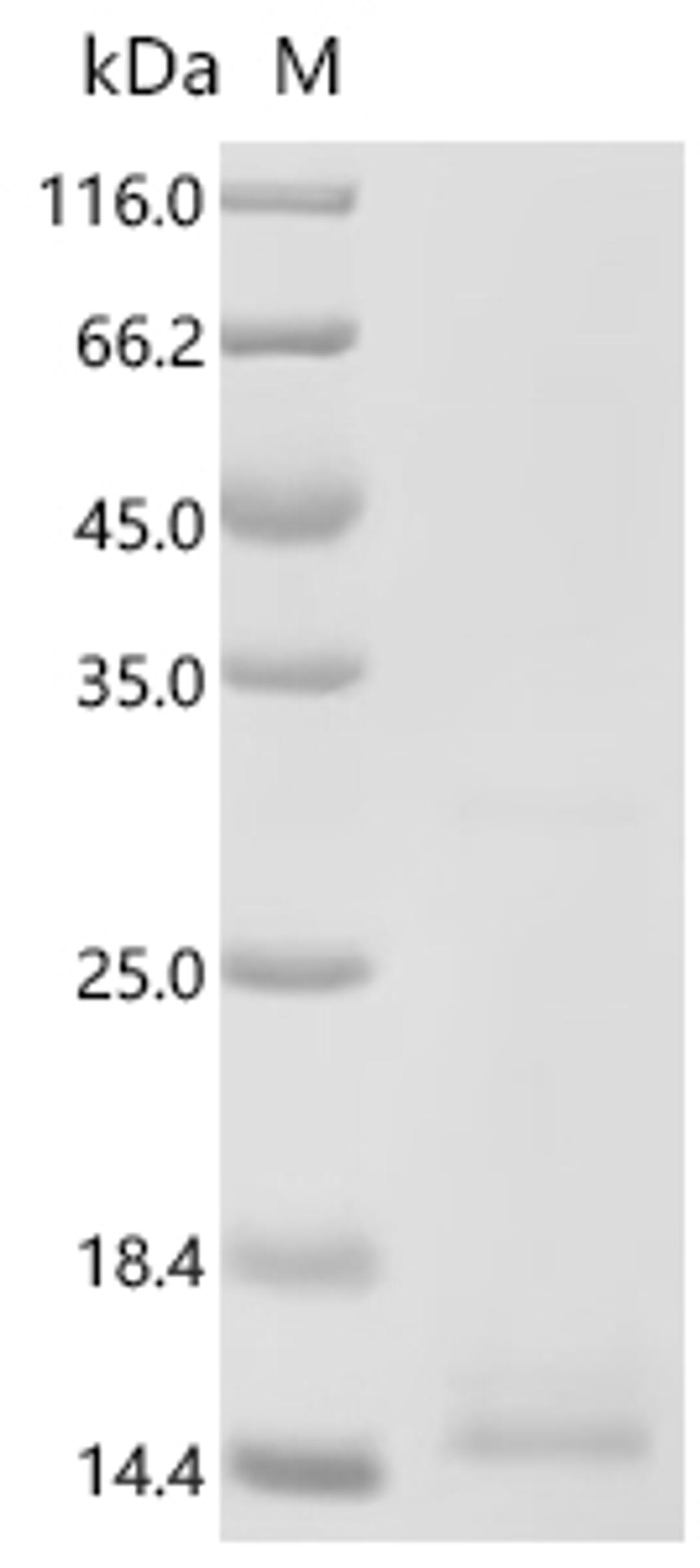 (Tris-Glycine gel) Discontinuous SDS-PAGE (reduced) with 5% enrichment gel and 15% separation gel.