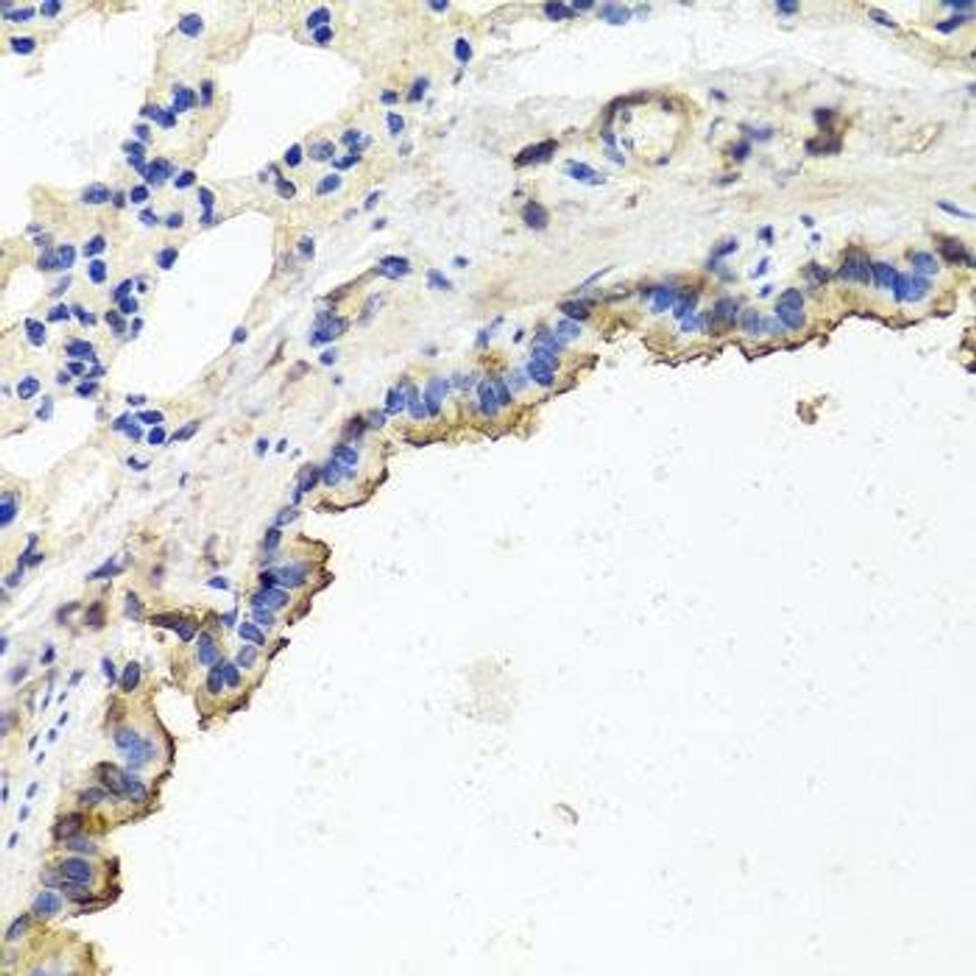 Immunohistochemical staining of rat lung tissue using TUBB8 antibody (dilution of 1:100)