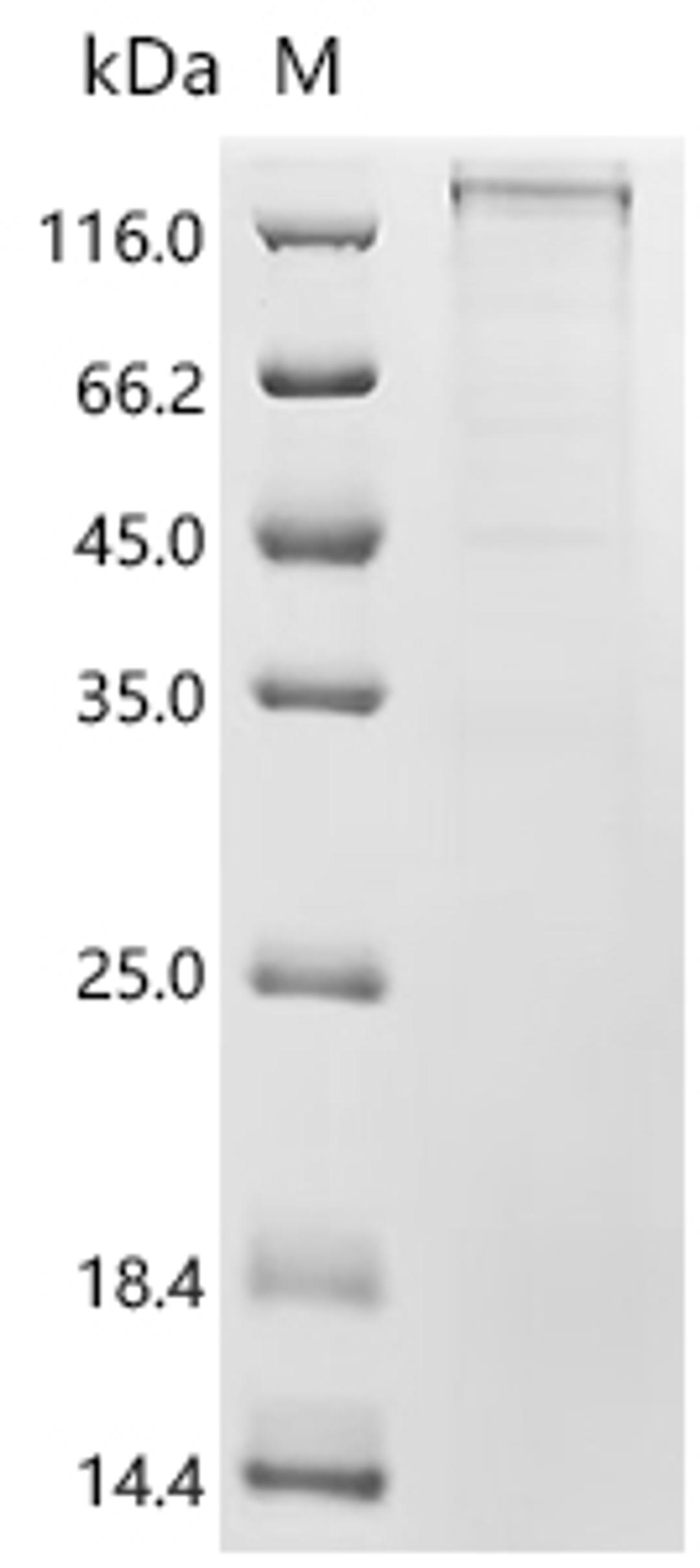 (Tris-Glycine gel) Discontinuous SDS-PAGE (reduced) with 5% enrichment gel and 15% separation gel.