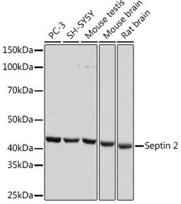 Western blot - Septin 2 Rabbit mAb (A7163)