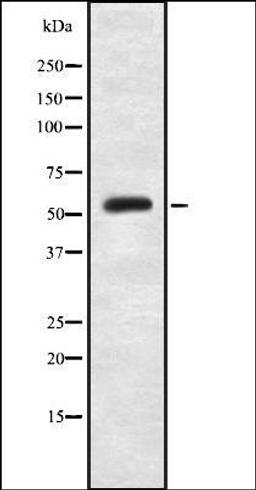 Western blot analysis of HeLa whole cell lysates using PKM2-phospho-Ser37- antibody