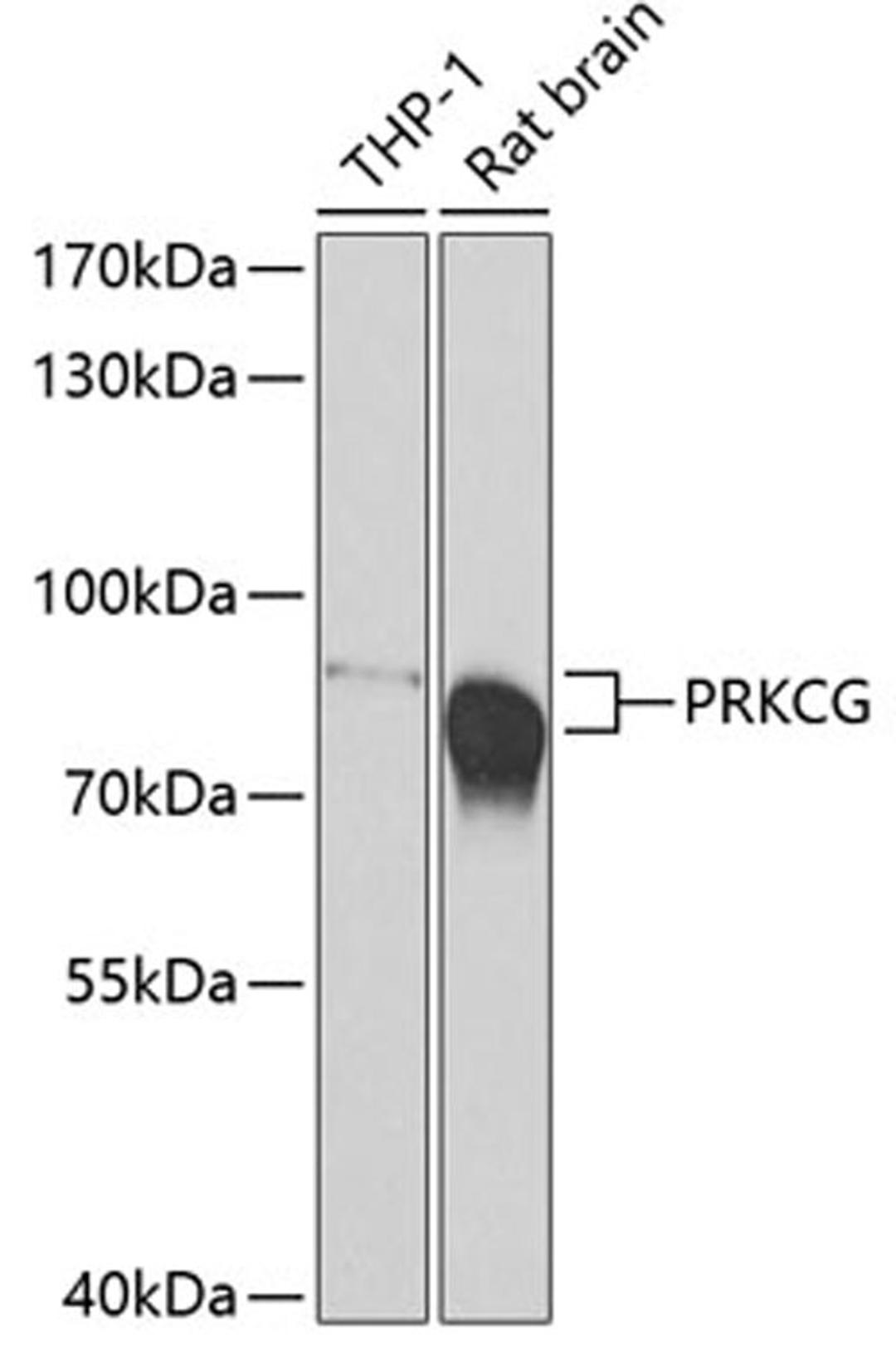 Western blot - PRKCG antibody (A7922)