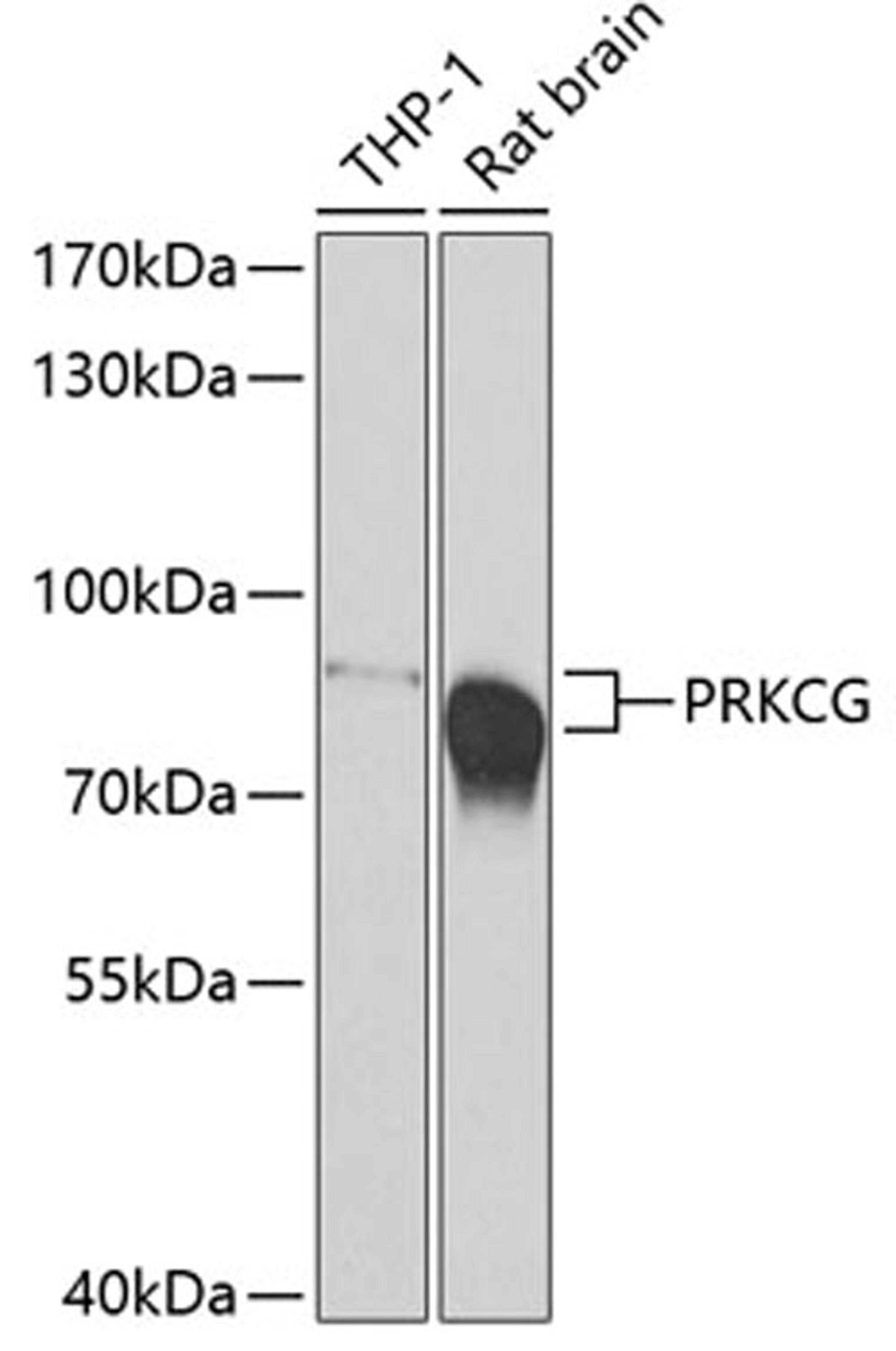 Western blot - PRKCG antibody (A7922)