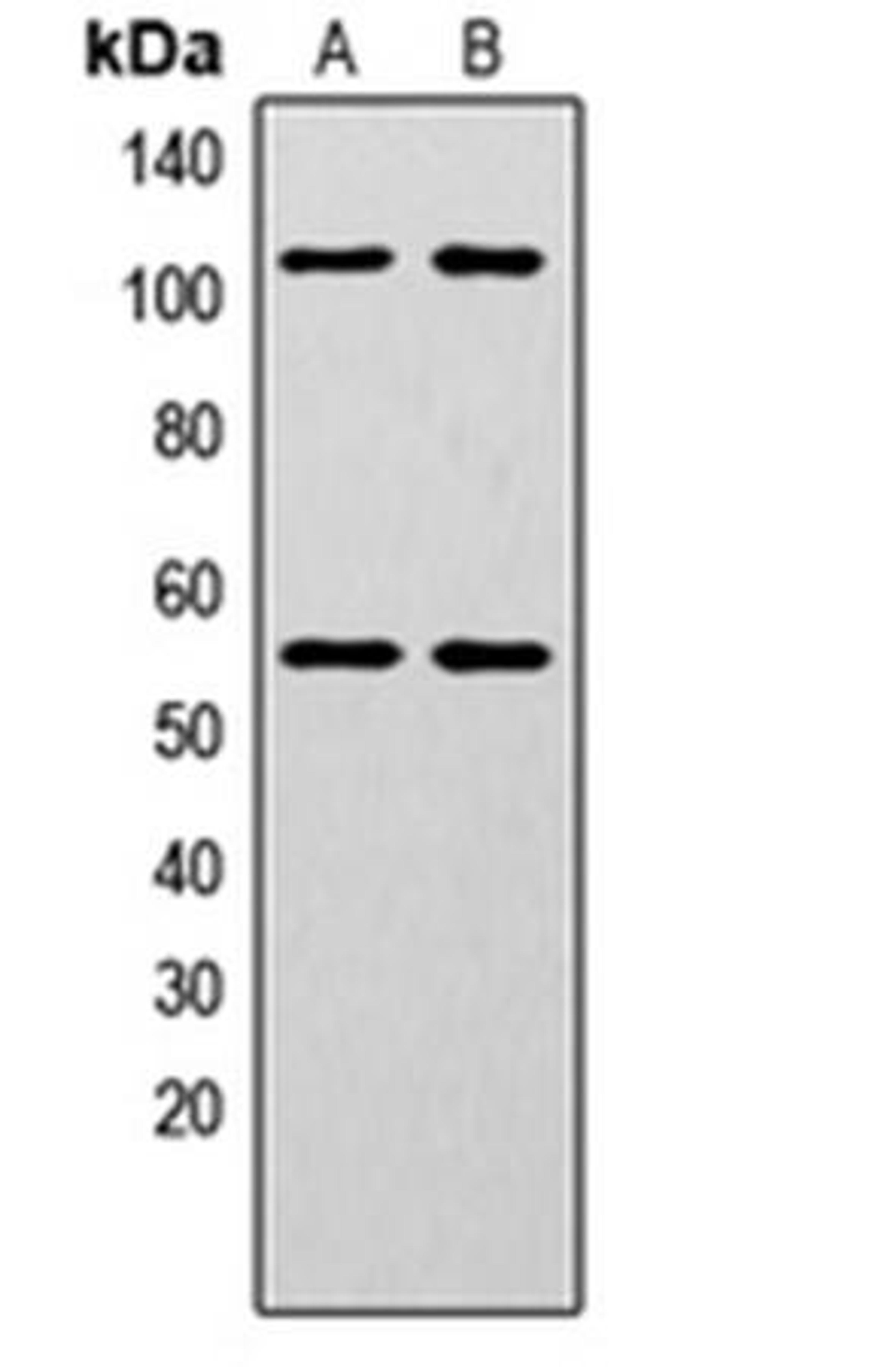 Western blot analysis of HeLa (Lane1), MCF7 (Lane2) whole cell using NF-kappaB p105/p50 (phospho-S337) antibody