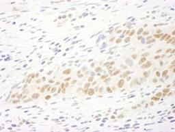 Detection of human MASTL by immunohistochemistry.