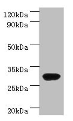 Western blot. All lanes: rbsK antibody at 2µg/ml + DH5a whole cell lysate. Secondary. Goat polyclonal to rabbit IgG at 1/10000 dilution. Predicted band size: 33 kDa. Observed band size: 33 kDa